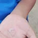 ভারতে শিক্ষার্থীদের হাতে গরম তেল ঢেলে শাস্তি