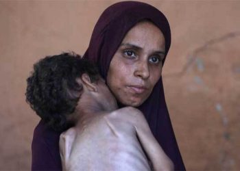 গাজায় অনাহারে শতাধিক শিশুর মৃত্যু
