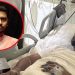 নুরের সর্বশেষ শারীরিক অবস্থা জানালেন ঢামেক পরিচালক
