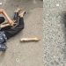 পুলিশের লাঠিচার্জ: রাস্তায় পড়ে ছিল জুলাই যোদ্ধার কৃত্রিম হাত