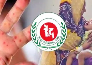 সিলেটে হাম উপসর্গে একদিনে ৫ শিশুর মৃত্যু