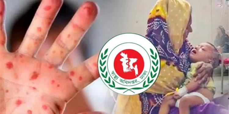 হাম ও হামের উপসর্গে আরও ৭ শিশুর মৃত্যু
