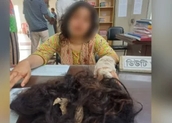 যৌতুকের টাকা না দেওয়ায় স্ত্রীর চুল কেটে পালালেন স্বামী