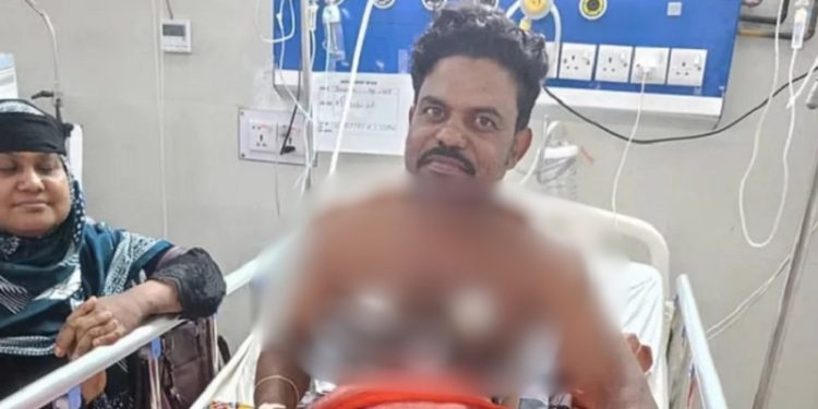 সাপের কামড় খেয়ে নিজেই হাসপাতালে চিকিৎসা নিচ্ছেন ‘বিষঝাড়া ওঝা’